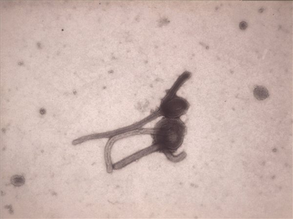 Ebola virus