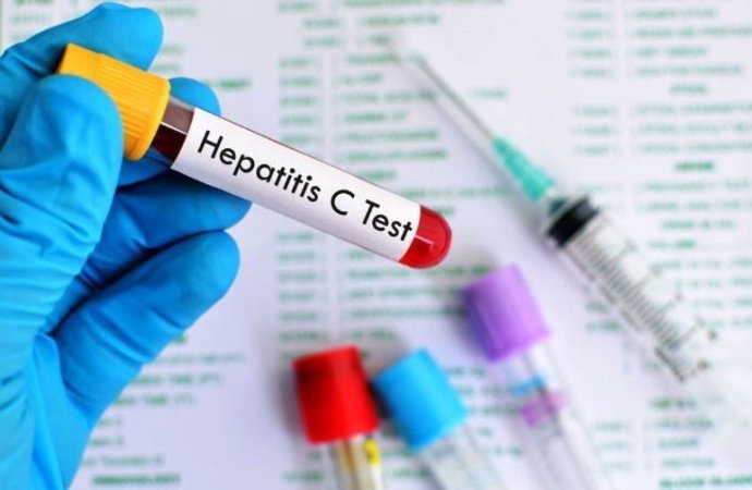 HepatitisC