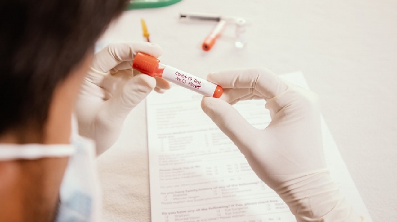 Koronavirusteszt n hd