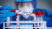 Koronavirus teszt covid jarvany